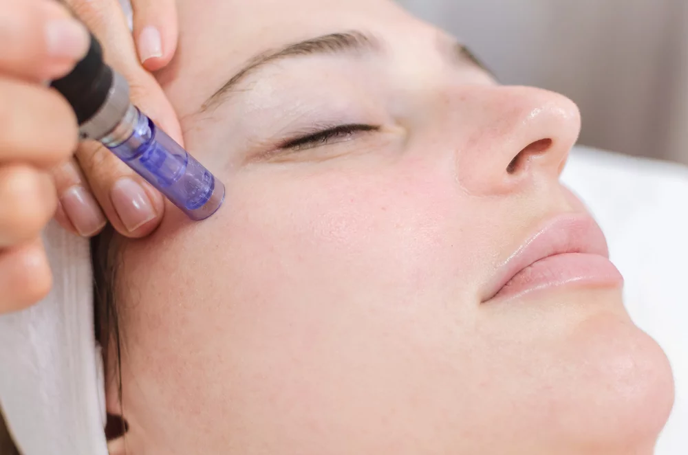 medelina health hydrapen microneedling facial treatment